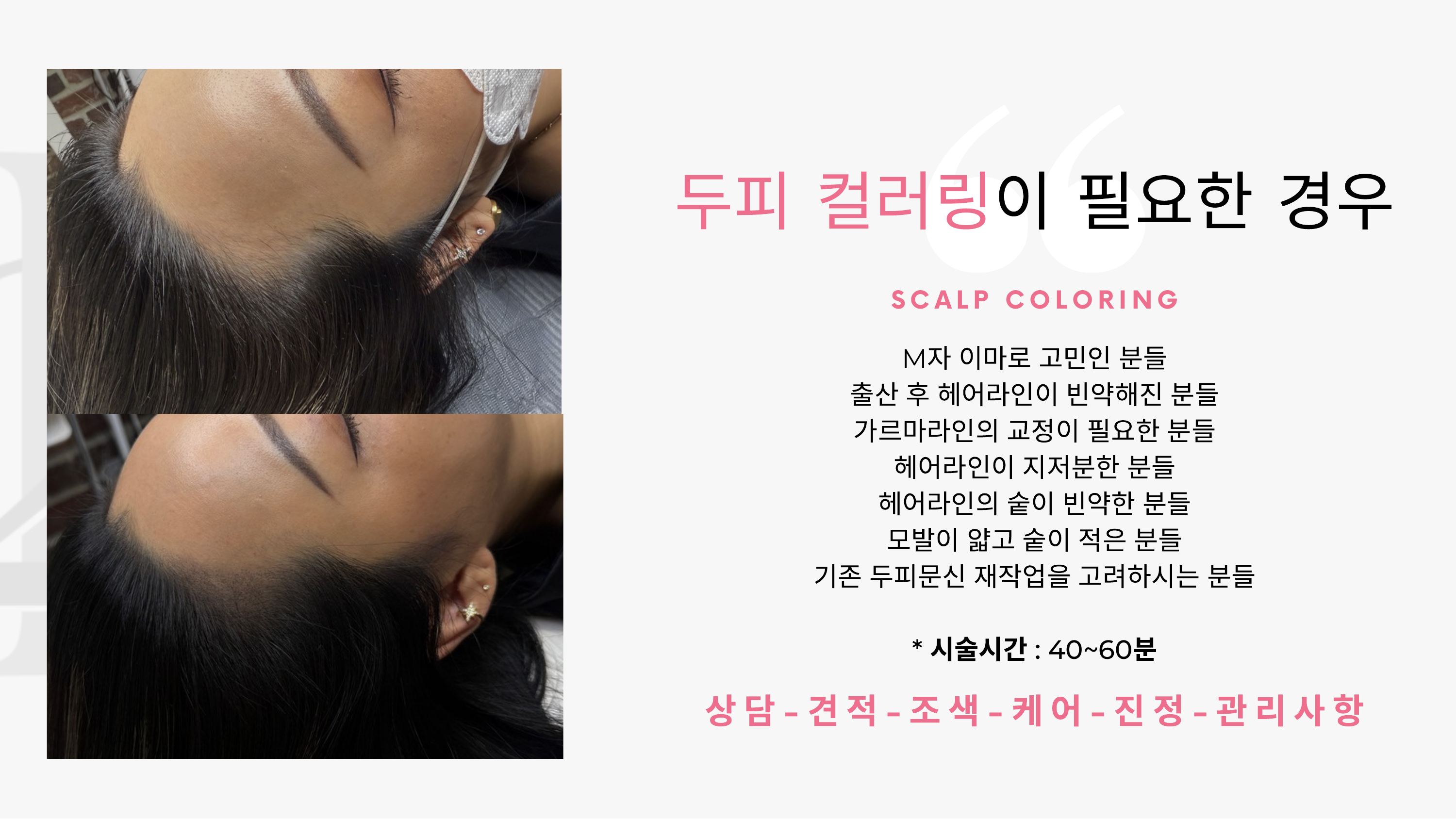 SCALP COLORING Before After