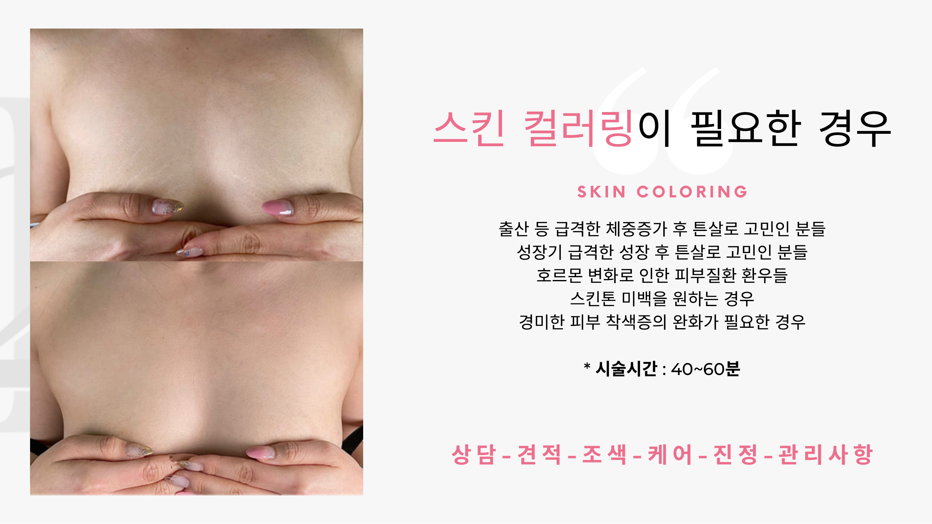 SKIN COLORING Before After