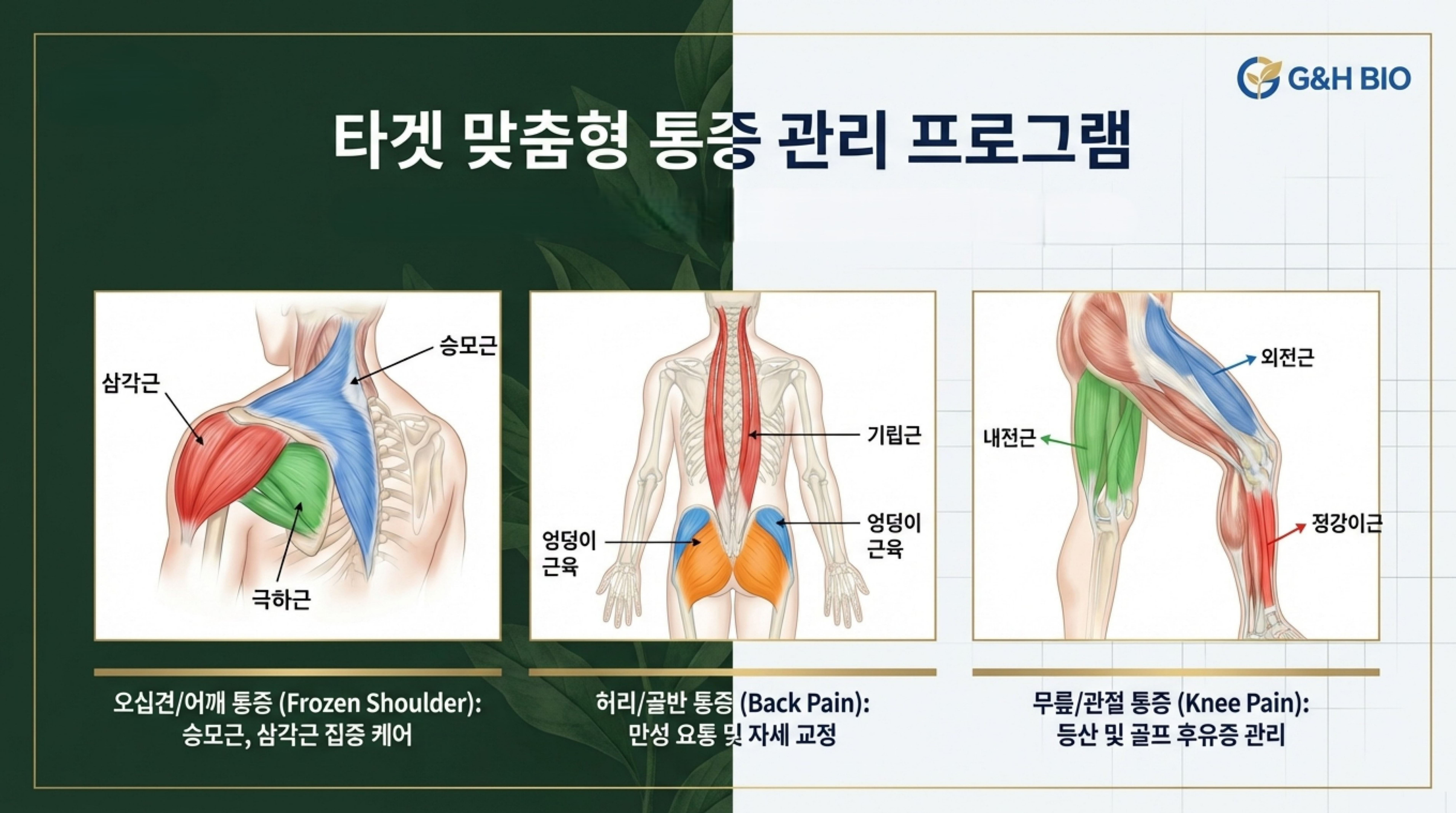 타겟 맞춤형 통증 관리 프로그램 - 오십견/허리/무릎