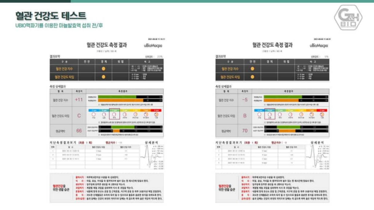 UBIO 맥파기 혈관 건강도 측정 결과