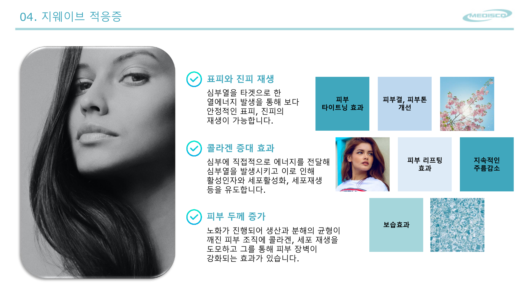 STAR WAVE indications - skin tightening/lifting/wrinkle reduction/hydration